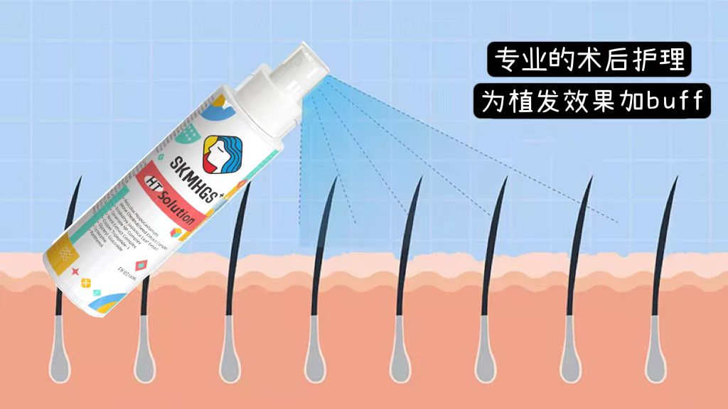 a7663f590fbcaf2df6afdfe44e99377a_640_wx_fmt=png&wxfrom=5&wx_lazy=1&wx_co=1 图片