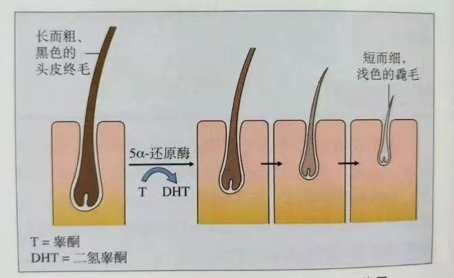 c3fd255c04ef7d831a3145419a85376c_640_wx_fmt=png&wxfrom=5&wx_lazy=1&wx_co=1 图片