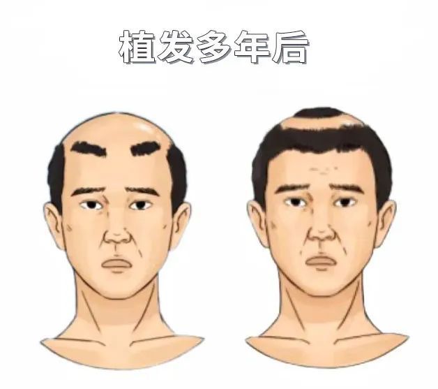 98fda9d4a28fbee00d9df3963a899c2c_640_wx_fmt=jpeg&wxfrom=5&wx_lazy=1&wx_co=1 图片