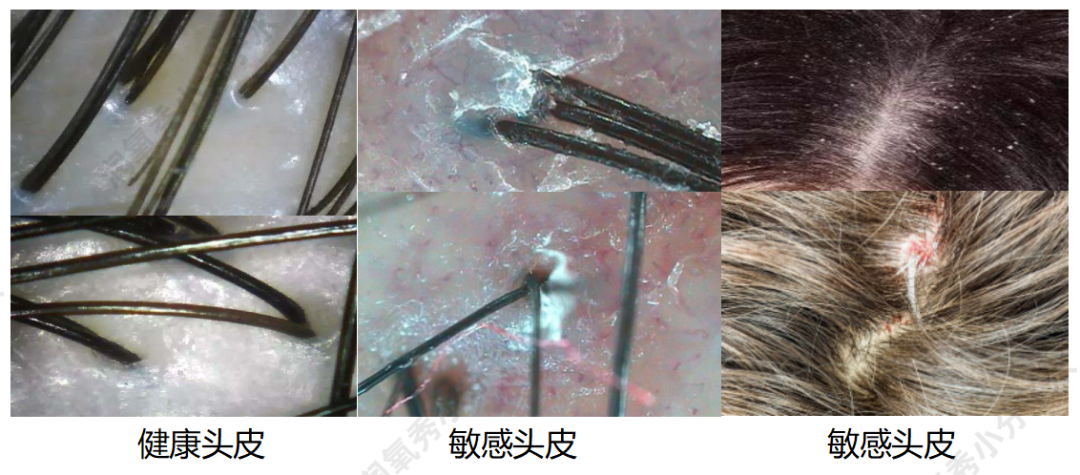 3e6ee0c1fcc9ab4bbb305dbfb583f2cb_640_wx_fmt=png&wxfrom=5&wx_lazy=1&wx_co=1