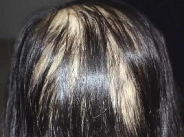 63009d49f97f6db9d5d7d52faae74636_640_wx_fmt=jpeg&wxfrom=5&wx_lazy=1&wx_co=1 图片