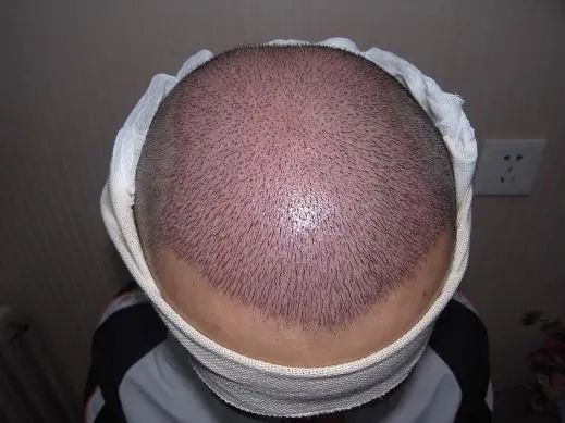 a6c782bd30577b2250ebe9ab376f6b39_640_wx_fmt=jpeg&wxfrom=5&wx_lazy=1&wx_co=1 图片