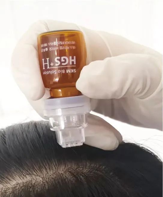 1335725aa9dcc91101f4656e8a9036ed_640_wx_fmt=jpeg&wxfrom=5&wx_lazy=1&wx_co=1 图片