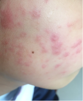 fc7df3f0a52e7396f2726b72c48e1825_640_wx_fmt=png&wxfrom=5&wx_lazy=1&wx_co=1 图片