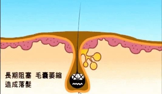 5ca8e7d3313cca479bacfb4b61ab795 图片