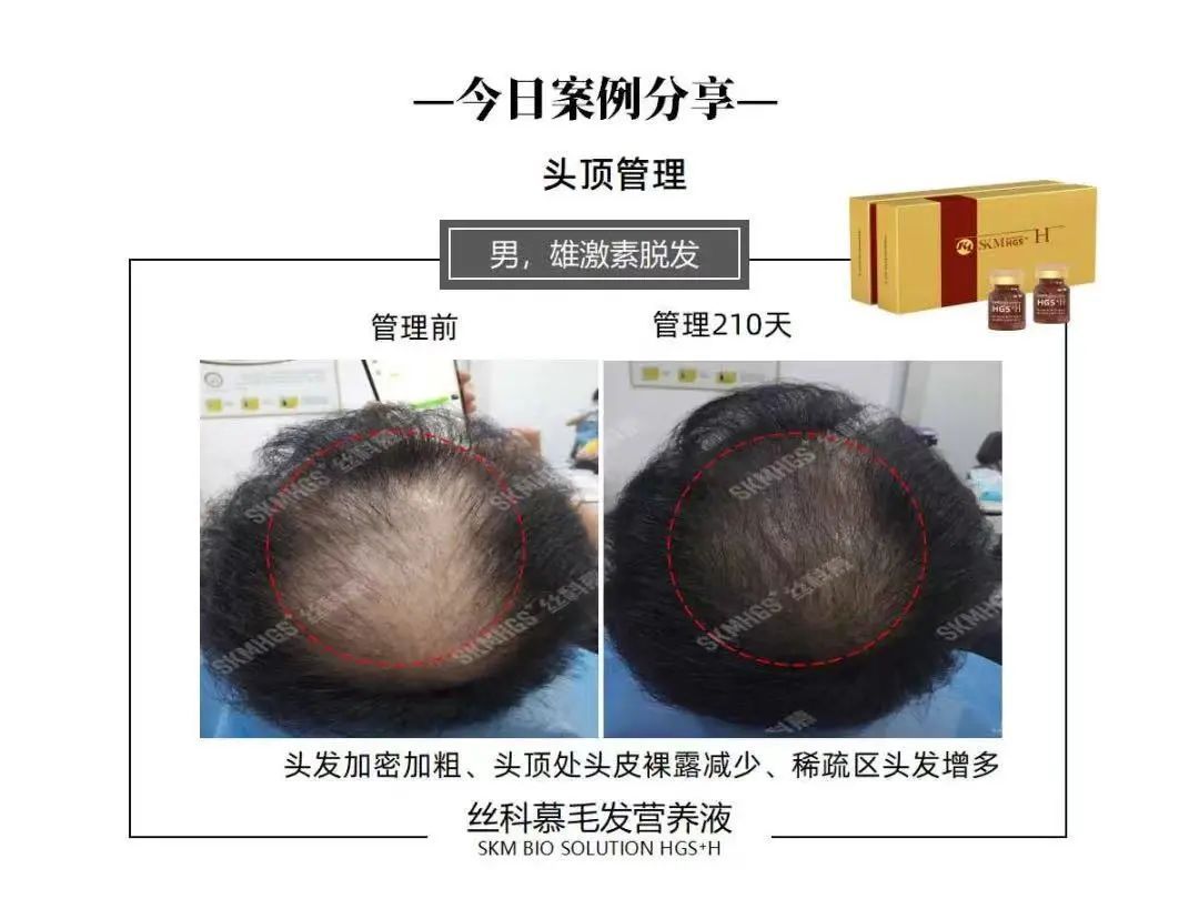 aa0eb7aba512691b9f1e8018c829e562_640_wx_fmt=jpeg&wxfrom=5&wx_lazy=1&wx_co=1 图片