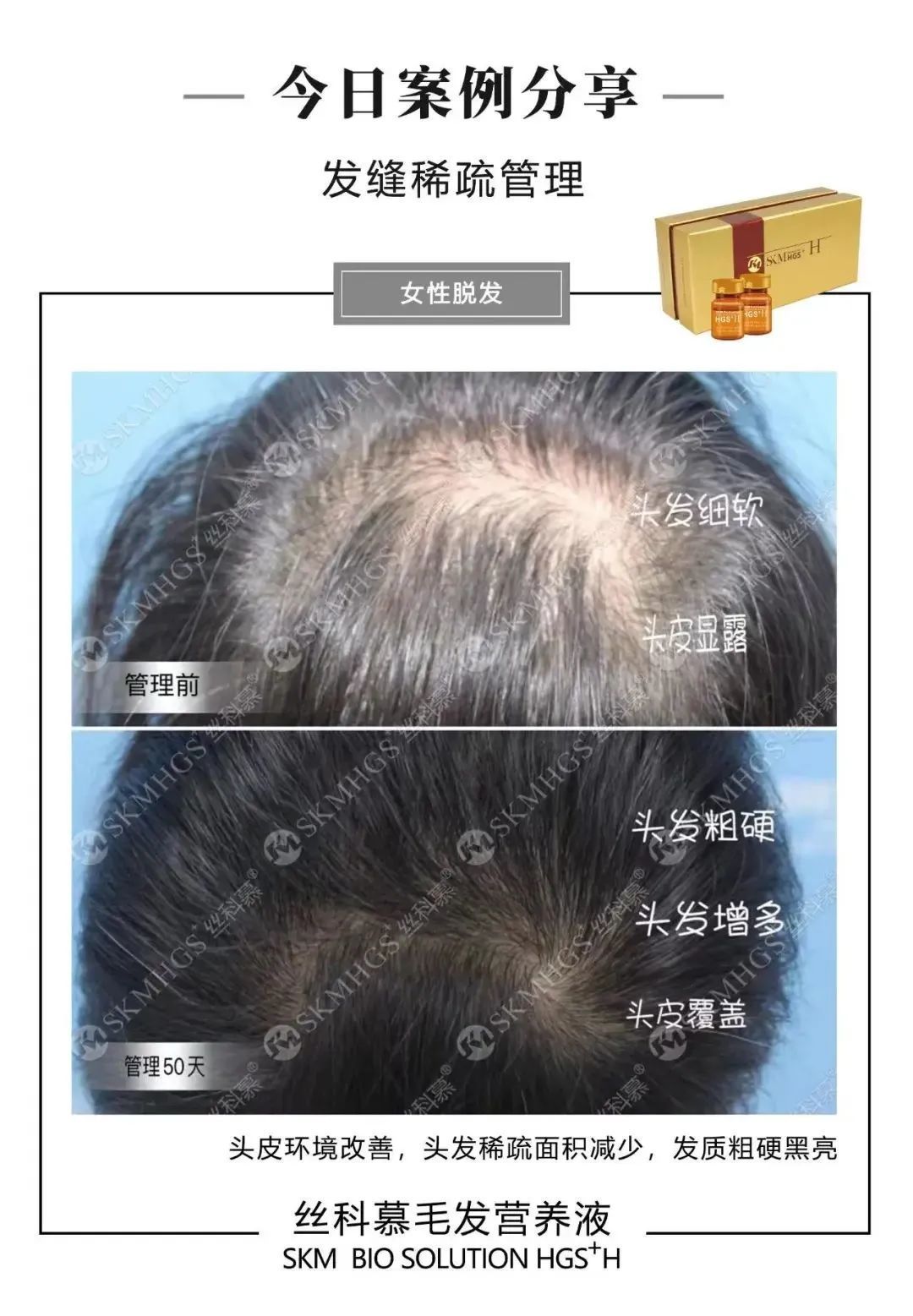 3d334d6ebc25dcb8c0aaf542ed756f0d_640_wx_fmt=jpeg&wxfrom=5&wx_lazy=1&wx_co=1 图片