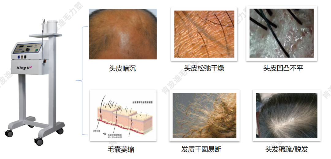 905cf3a9a999311f14dbd0faa117da33_640_wx_fmt=png&wxfrom=5&wx_lazy=1&wx_co=1 图片