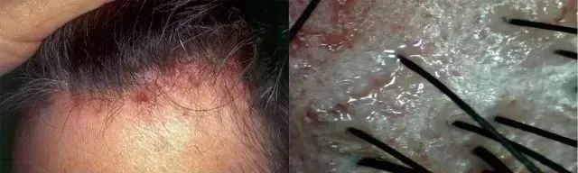 c7c2b695faf1fd0e4a8783c8dc2ca3ea_640_wx_fmt=jpeg&wxfrom=5&wx_lazy=1&wx_co=1 图片