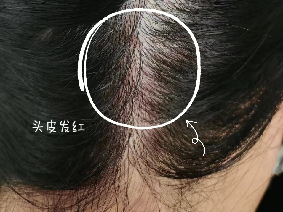 a72c4ab32582ebb0c72c03e1641f557d_640_wx_fmt=png&wxfrom=5&wx_lazy=1&wx_co=1 图片