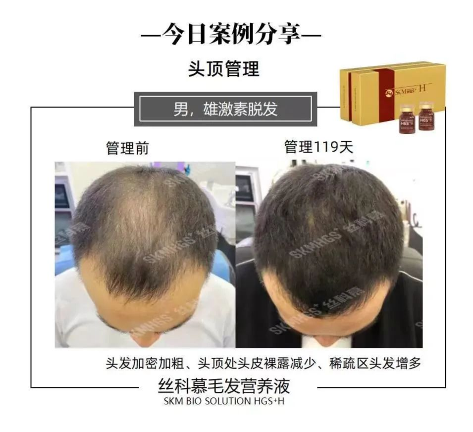 5b0263818b105750e6874a15c1d32f65_640_wx_fmt=png&wxfrom=5&wx_lazy=1&wx_co=1 图片