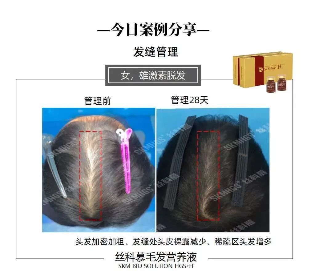 46c57b4aa9b64673bbcfe5d4c4c7b147_640_wx_fmt=jpeg&wxfrom=5&wx_lazy=1&wx_co=1 图片