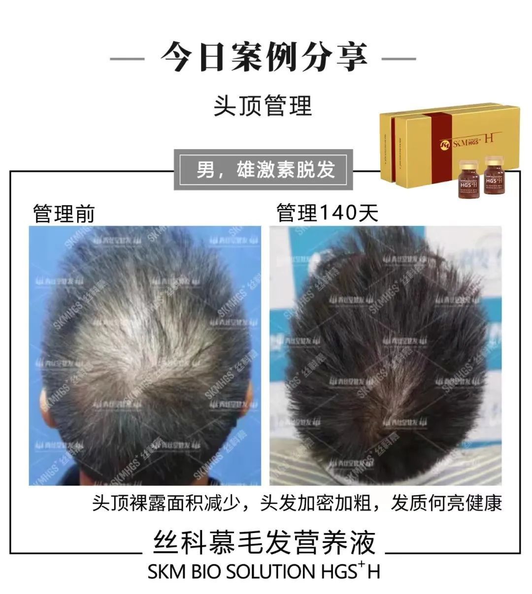 0243e5f8aa19bc01d3b34c0ea3d8495c_640_wx_fmt=jpeg&wxfrom=5&wx_lazy=1&wx_co=1 图片