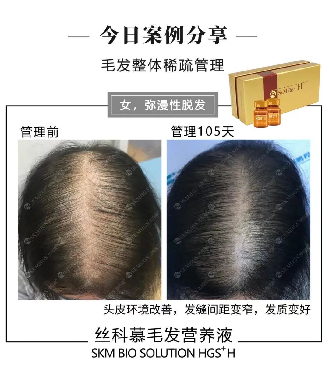 d29dd9332f1e0b56e0a2a142702a7eac_640_wx_fmt=jpeg&wxfrom=5&wx_lazy=1&wx_co=1 图片