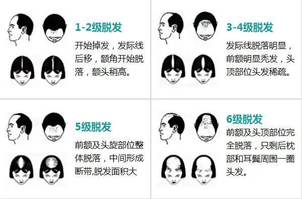 0081c15b4043bf68b422b20d2789db92_640_wx_fmt=jpeg&wxfrom=5&wx_lazy=1&wx_co=1 图片