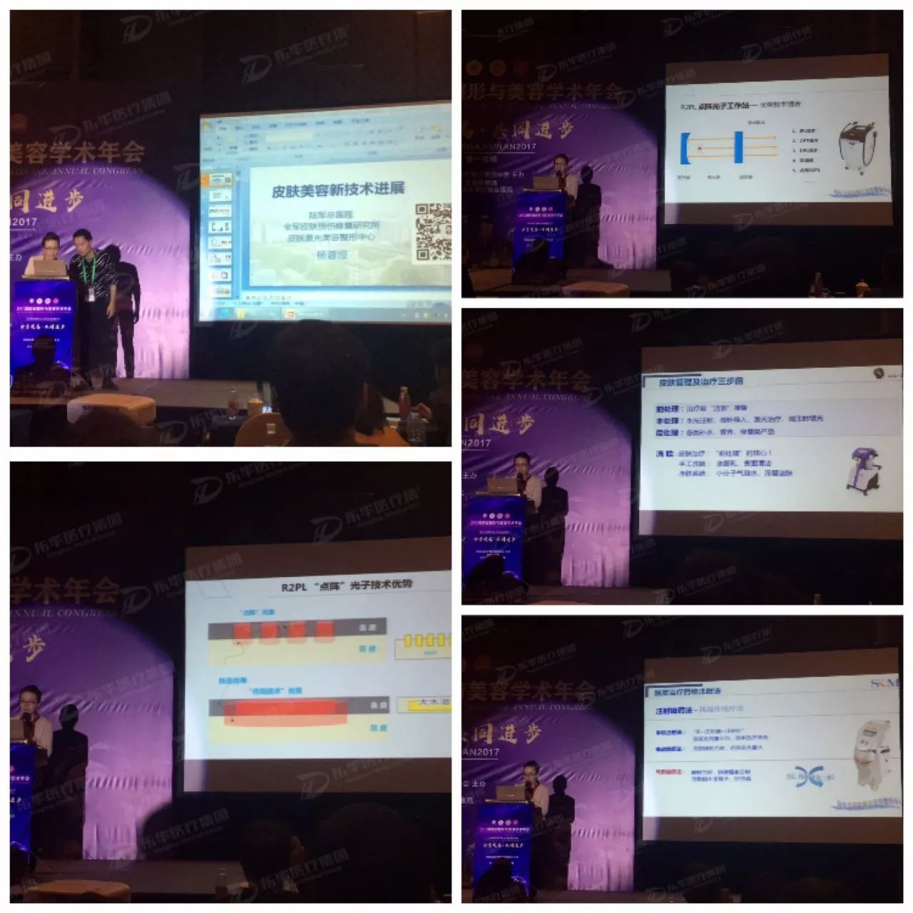 皮肤美容新进展-杨蓉娅