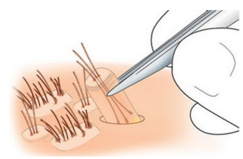 f42332bb4d4a716fbaf26c4042d77f6d_640_wx_fmt=png&wxfrom=5&wx_lazy=1&wx_co=1 图片