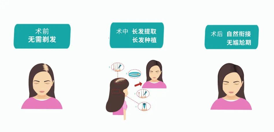 fdffa02c81bc08bd7ac47c215b8f9202_640_wx_fmt=jpeg&wxfrom=5&wx_lazy=1&wx_co=1 图片